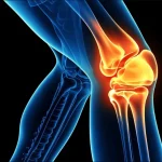 What Is N-Acetylglucosamine Used For?